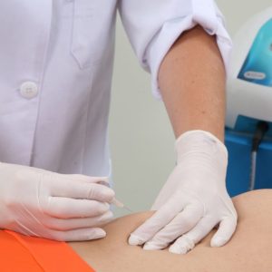 Carboxiterapia